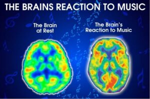 zene hatása sport közben az agyra